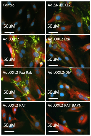 LOXL2 processing by FXa reduces total LOX activity in the cell-derived ECM. Representative confocal microscopy images of in situ LOXs activity (green), LOXL2 (red), and nuclei (DAPI, blue) for the following conditions: (1) control A7r5s cells, (2) ΔN-LOXL2 overexpression, (3) wild-type LOXL2 overexpression (4) LOXL2 overexpression with FXa incubation (1 μg/ml), (5) LOXL2 overexpression with FXa (1 μg/ml) and rivaroxaban (50 nM) incubation, (6) catalytically inactive LOXL2-DM overexpression, (7) LOXL2 overexpression + LOXL2-specific inhibitor PAT-1251 (10 µM), (8) LOXL2 overexpression + inhibitors BAPN (10 µM) + PAT-1251 (10 µM). (Scale bar = 50 μm). Source: <b>Lysyl oxidase-like 2 processing by factor Xa modulates its activity and substrate preference</b> by Huilei Wang, Alan Poe, Marta Martinez Yus, Lydia Pak, Kavitha Nandakumar & Lakshmi Santhanam. <em>Communications Biology</em>. April 2023.