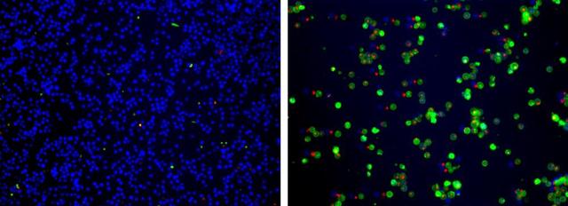 The fluorescence images showing cells that are live (blue, stained by CytoCalcein&trade; Violet 450), apoptotic (green, stained by Apopxin&trade; Green), and necrotic (red, indicated by 7-AAD staining) in Jurkat cells induced by 1&micro;M staurosporine for 3 hours. The fluorescence images of the cells were taken with Olympus fluorescence microscope through the Violet, FITC and Texas Red channel respectively. Individual images taken from each channel from the same cell population were merged as shown above. Left: Non-induced control cells; Right: Triple staining of staurosporine-induced cells.