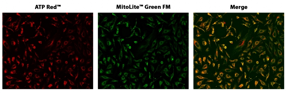 HeLa cells co-stained with ATP Red™ and MitoLite™ Green FM