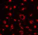 Image of HeLa cells stained with Cell Navigator® Lysosomal Staining Kit in a Costar black wall/clear bottom 96-well plate using an Olympus fluorescence microscope TRITC channel.