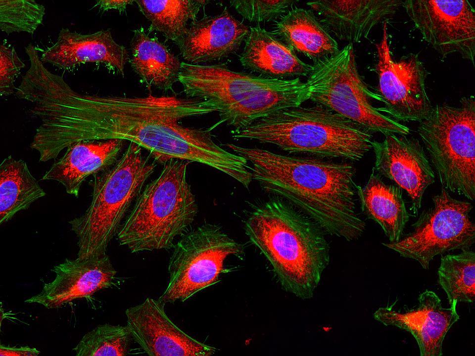 Fluorescence images of HeLa cells stained with Cell Navigator® Mitochondrion Staining Kit *Red Fluorescence* using fluorescence microscope with a Texas Red&reg; filter set. Live cells were stained with mitochondria dye MitoLite&trade; Red (Red). After fixation, the cells were labeled with F-actin dye iFluor® 488-Phalloidin (Cat#23115, Green) and counterstained with Nuclear Blue&trade; DCS1 (Cat#17548, Blue).