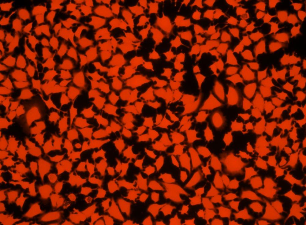 Image of HeLa cells in a 96-well Costar black wall/clear bottom plate stained with CytoTrace&trade; Red CFDA (TRITC filter).