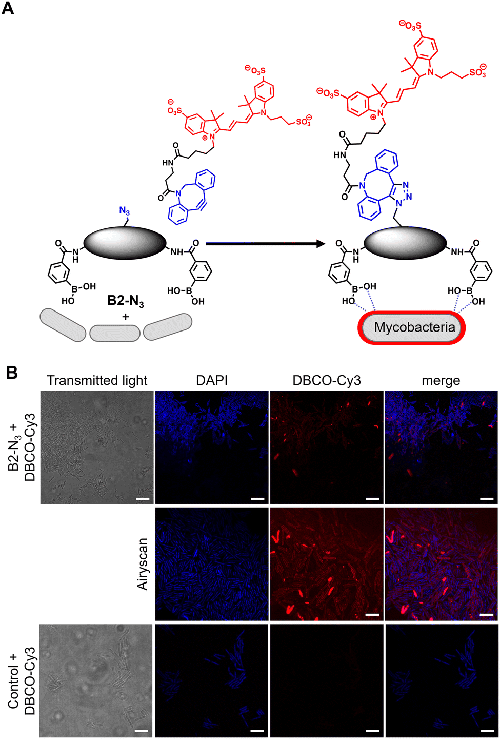 (A) Strategy for ‘click’-capture of B2-N3 with DBCO-Cy3 (B) fluorescence microscopy of B2-N3 labelled Mycobacterium smegmatis with DBCO-Cy3 via SPAAC. Scale bars are 5 μm. Source: <b>Imaging of antitubercular dimeric boronic acids at the mycobacterial cell surface by click-probe capture</b> by Collette S. Guy, Ruben M. F. Tomás, Qiao Tang, Matthew I. Gibson and Elizabeth Fullam. <em>Chem. Commun.</em>, Aug. 2022.