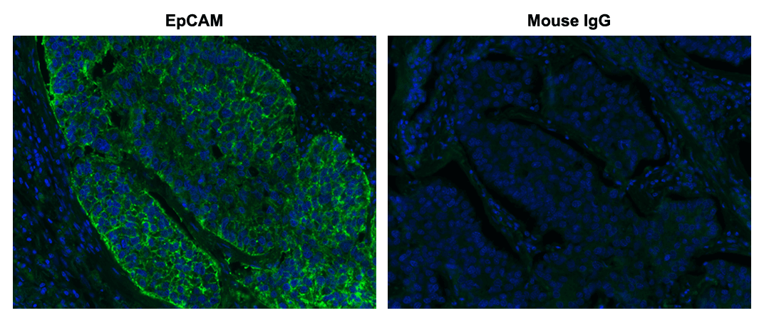 Formalin-fixed, paraffin-embedded (FFPE) human lung adenocarcinoma tissue was incubated with an anti-EpCAM primary antibody, and an HRP conjugated anti-mouse secondary antibody. TSA signal was developed by incubation of tissue section with 5 µg/mL of iFluor® 488 tyramide (Cat No. 45100) for 10 minutes. Images were acquired on a confocal microscope equipped with a GFP filter set.