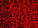 Image of Hela cells fixed with formaldehyde and stained with Live or Dead&trade; Fixable Dead Cell Staining kit&nbsp;*Red Fluorescence*&nbsp;in a Costa black wall/clear bottom 96-well plate.