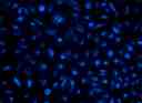 Image of HeLa cells stained with LysoBrite™ Blue in a Costar black wall/clear bottom 96-well plate.