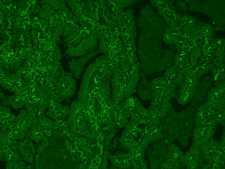 Formalin-fixed, paraffin-embedded (FFPE) human lung tissue was labeled with anti-EpCAM mouse mAb followed by HRP-labeled goat anti-mouse IgG (Cat No. 16728). The fluorescence signal was developed using mFluor™ Red 780 styramide (pseudo color: green) and detected with a Cy5 filter set.