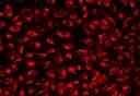 Image of U2OS cells stained with MitoLite&trade; Red FX600 in a Costar black wall/clear bottom 96-well plate.