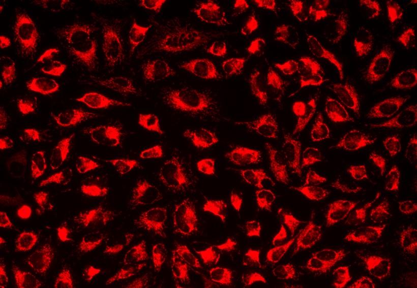 Image of U2OS cells stained with MitoLite&trade; Red FX600 in a Costar black wall/clear bottom 96-well plate.
