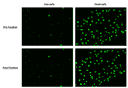 Image of live and dead HeLa cells stained with Nuclear Green™ Fixable DCS1 dye. Images were acquired before and after fixation with 4% formaldehyde by fluorescence microscopy equipped with a FITC filter set.
