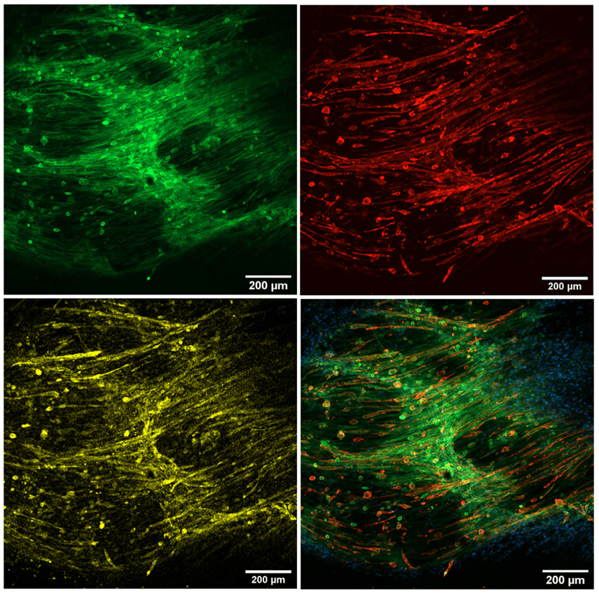Myogenic differentiation in 3D bioprinted models. Bioprinted rings after 15 days of culture in GM with differentiated fibers expressing α-actinin (yellow) and MHC (red). F-actin (green) and nuclei (blue) are also stained. Scale bar = 200 μm. Actin was stained with Phalloidin-iFluor 488. Source: <b>3D bioprinted functional skeletal muscle models have potential applications for studies of muscle wasting in cancer cachexia</b> by Andrea García-Lizarribar et.al., <em>Biomaterials Advances</em> April 2023.