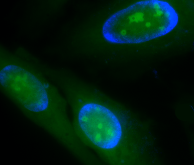 RNA staining in live HeLa cells