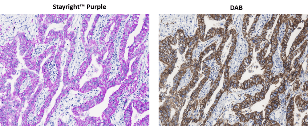 ReadiUse™ StayRight Purple IHC stain