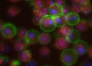 Apoptosis image