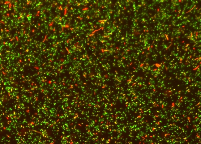 MycoLight&trade; Rapid Fluorescence Bacterial Gram Stain Kit