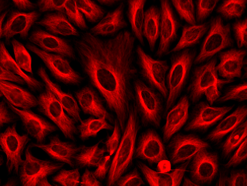 Biotinylated GAR Tubulin Stain