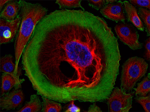 HeLa cells stained with rabbit anti-tubulin 