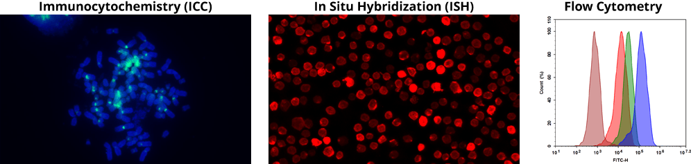 ICC stain;FISH stain;Flow Data