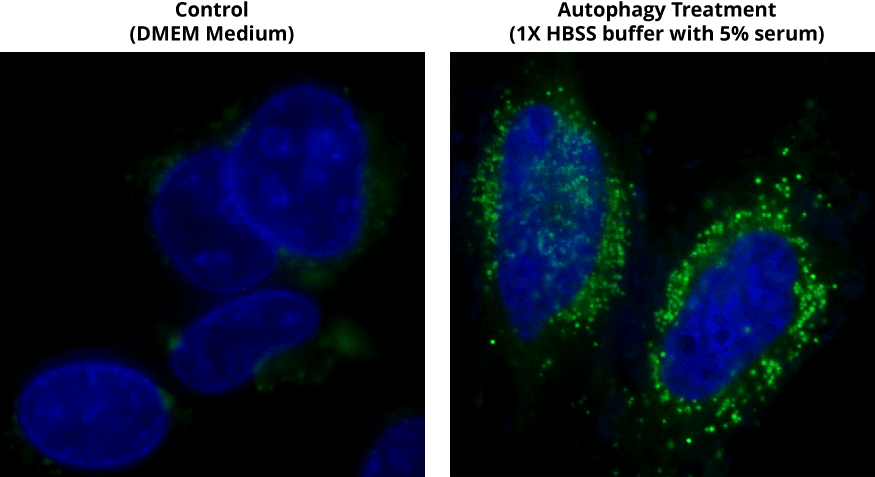 Control;Autophagy Treatment