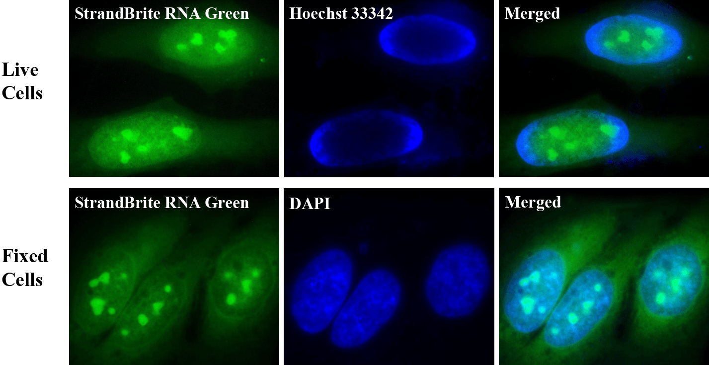 Fluorescence images of live and fixed HeLa cells stained with StrandBrite RNA Green.
