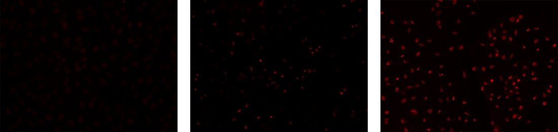 Fluorescence images of TUNEL reaction in HeLa cells 