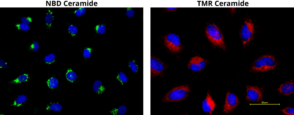 NBDCeramide;TMRCeramide