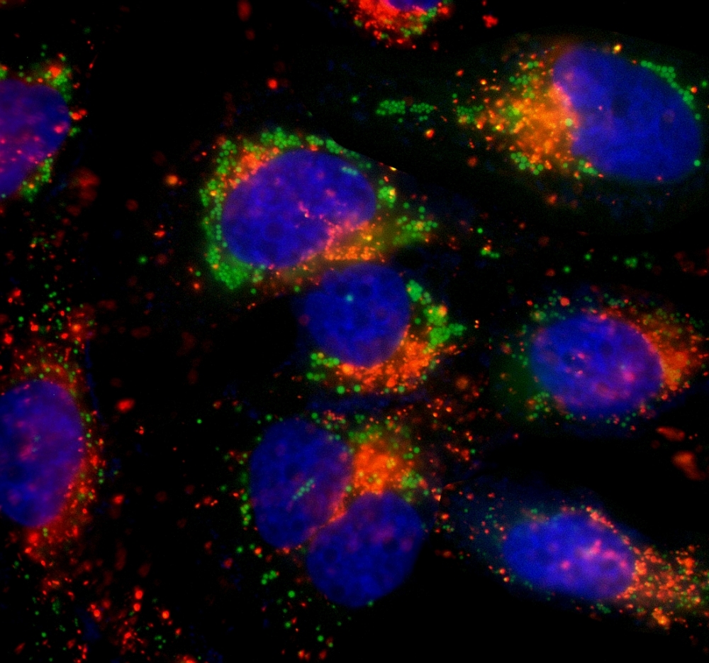 ICC Hoechst 33342 counterstain