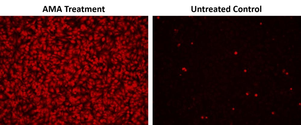 Images of superoxide measurement in HeLa cells using Cell Meter™ Fluorimetric Intracellular Superoxide Detection Kit