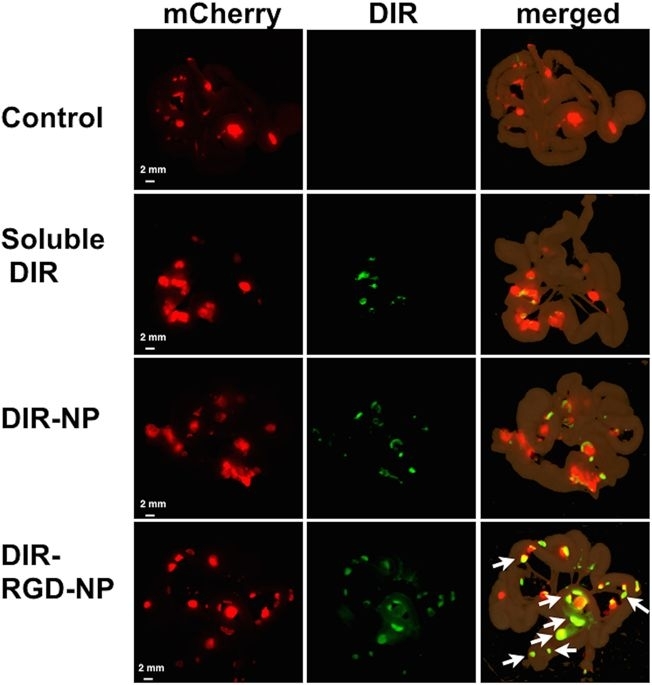 Staining of microtumors with DIR-RGD-NP