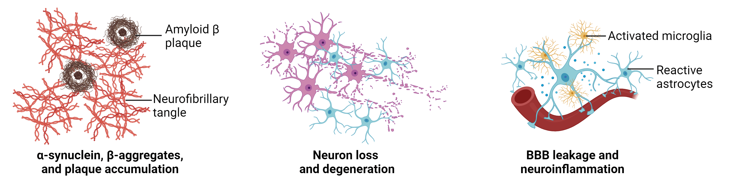 Histopathological Features of Parkinson's and Alzheimer's Disease