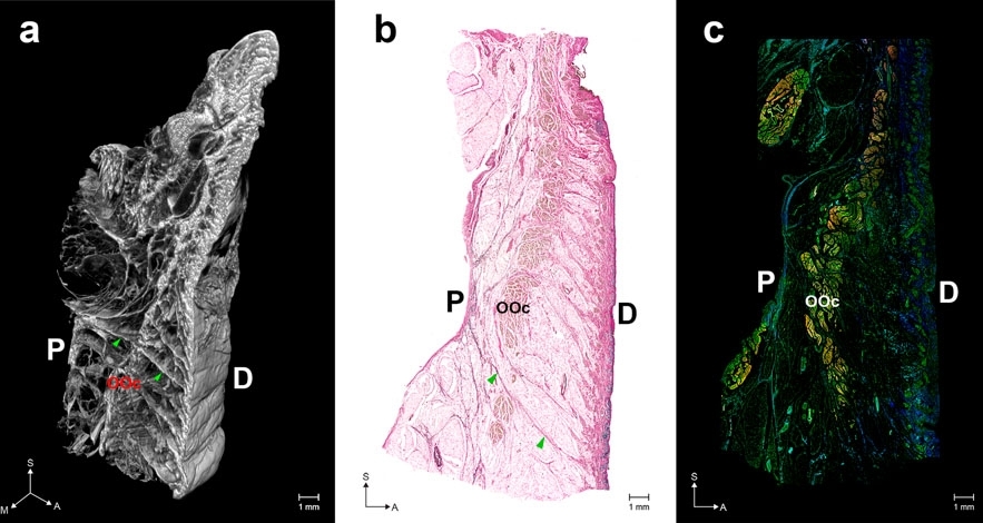 Structure of the orbicularis retaining ligament