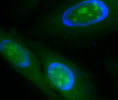 Fluorescence image of RNA staining in live HeLa cells. 