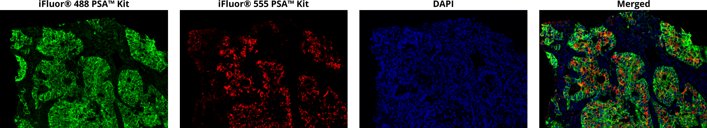 iFluor® PSA Imaging kits