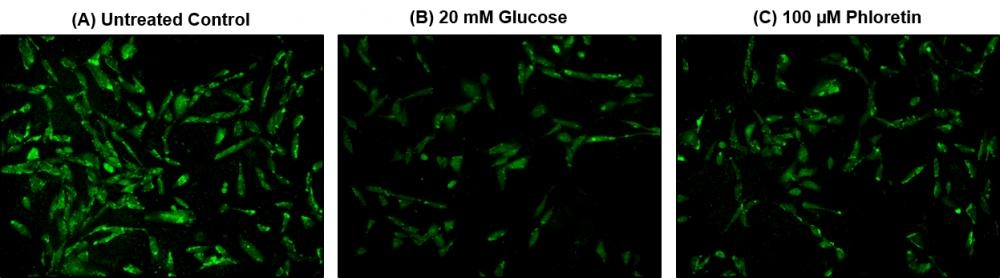 Fluorescence images of 2-NBDG uptake in CHO-K1 cells using Cell Meter™ 2-NBDG Glucose Uptake Assay Kit. 
