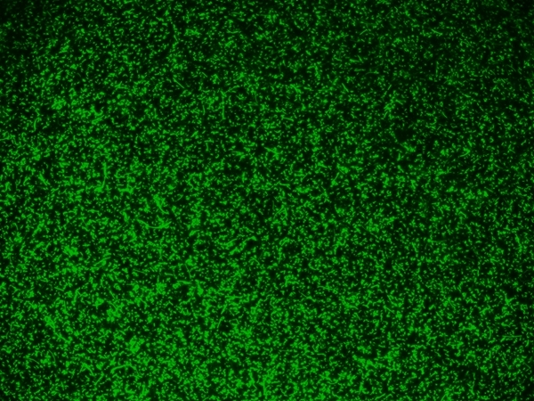 E.Coli were stained with 5 uM of MycoLight™ Green JJ98 for 30 minutes and imaged with FITC channel.