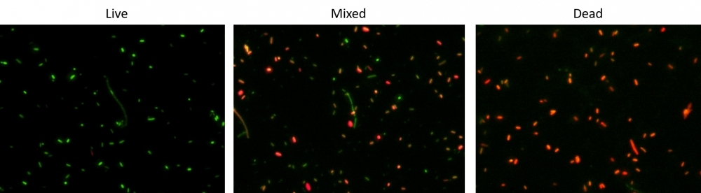 Fluorescence images of E. coli HST08 stained with Cell Meter™ Bacterial Viability Assay Kit (Cat#22400). 