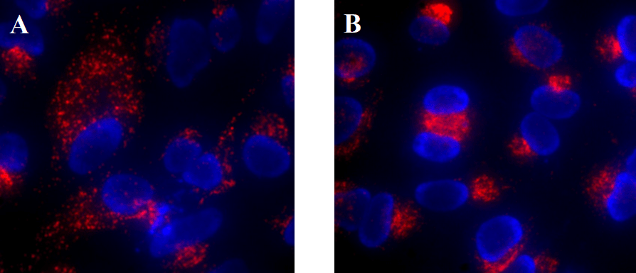 Lysosome localization and motility