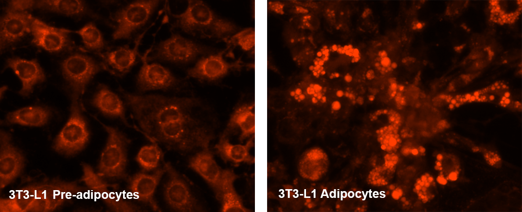 pre-adipocytes;adipocytes