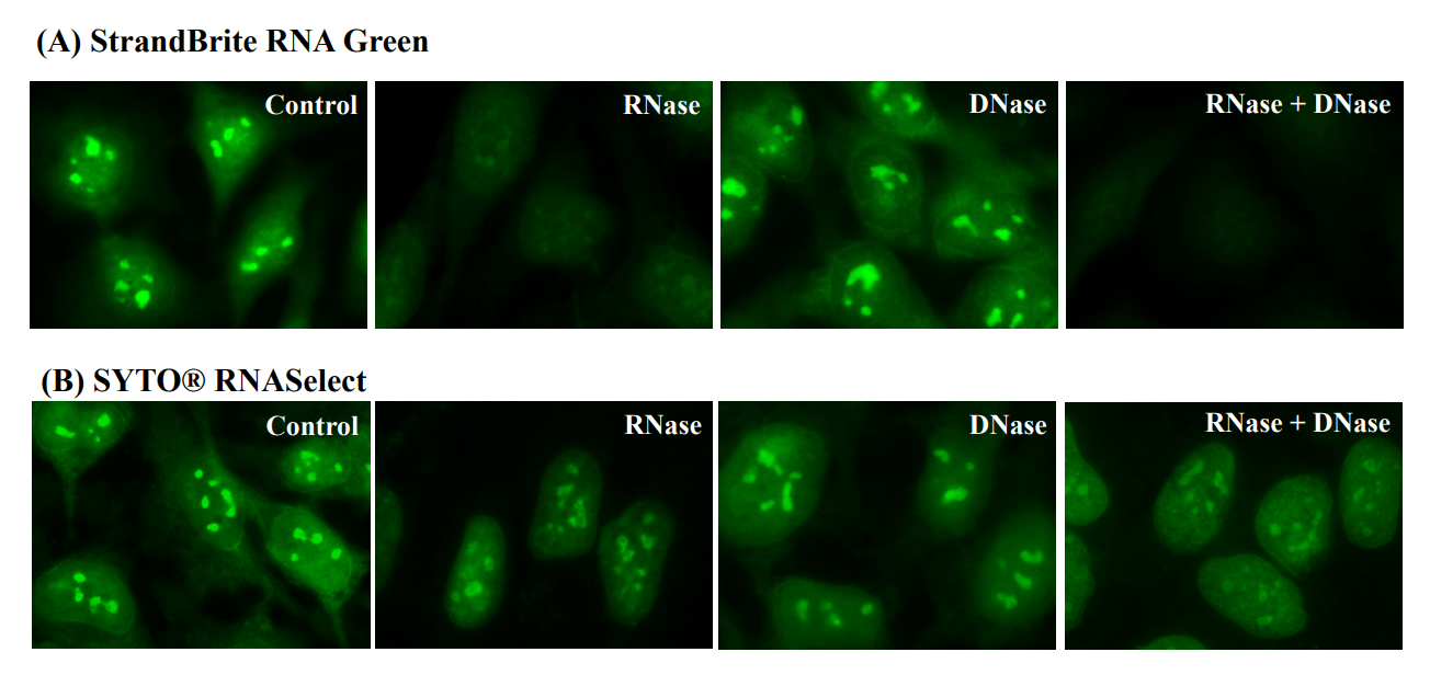 RNase and DNase digest test