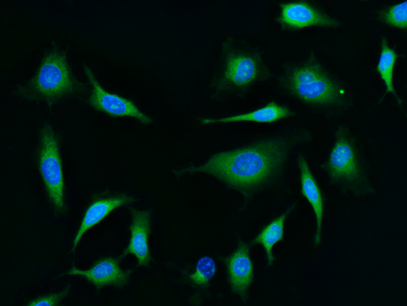 HeLa cells