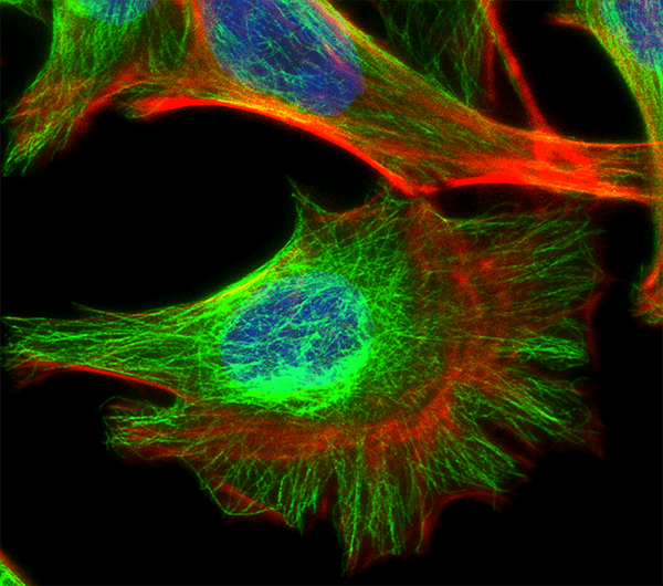 Hela Cells