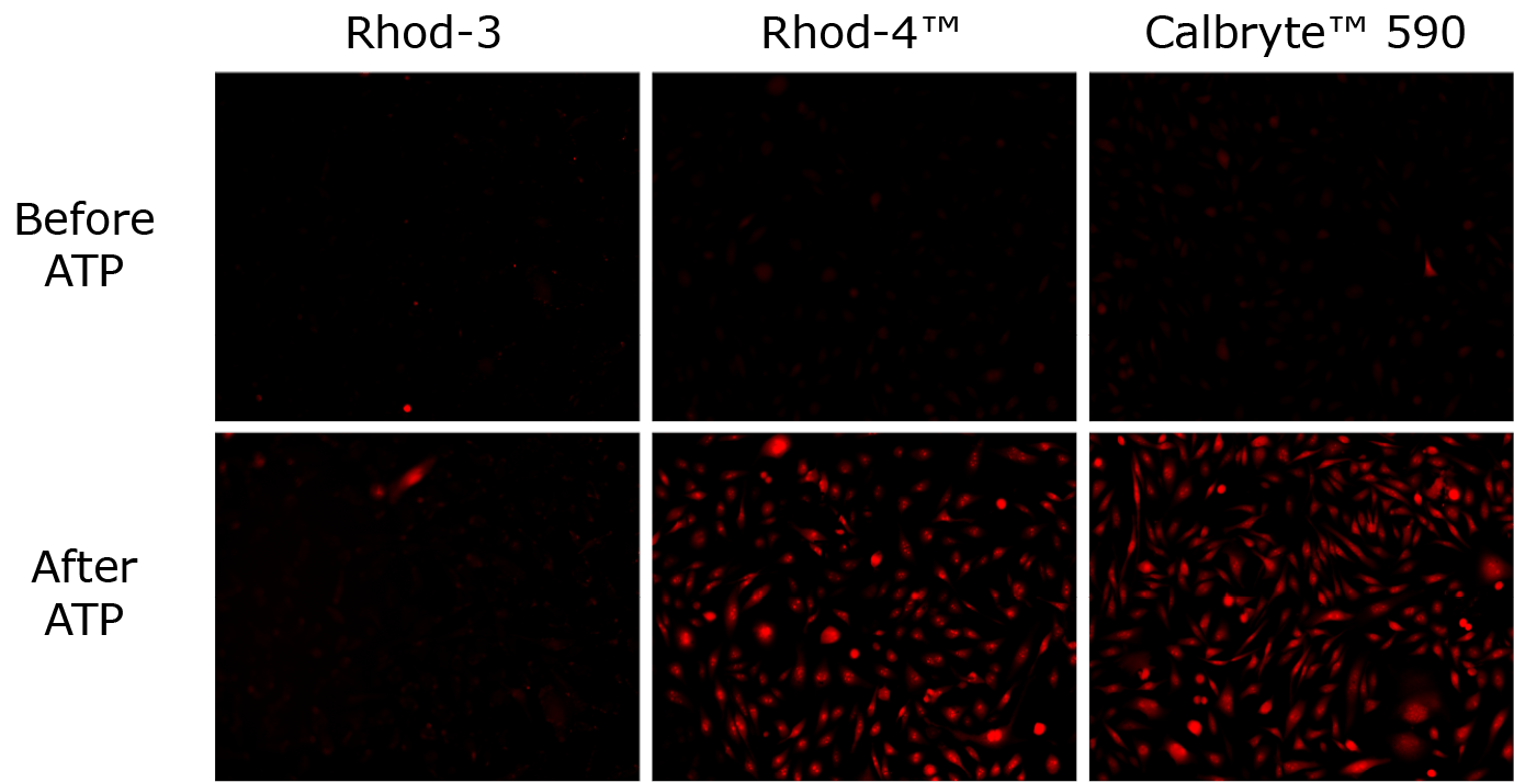 Fluorescence imaging