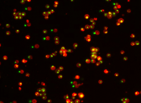 Apoptotic Jurkat cells