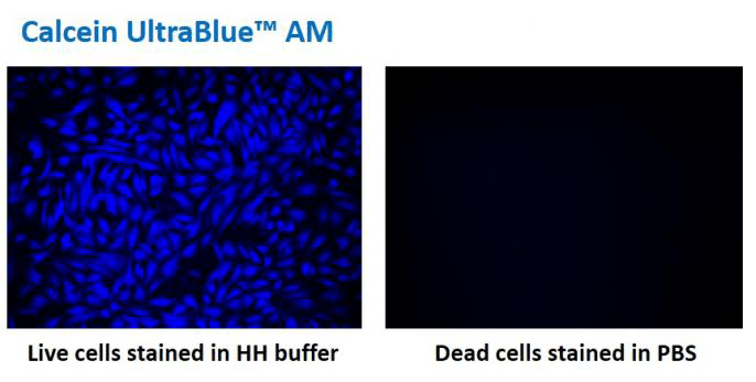 Fluorescence images of HeLa cells