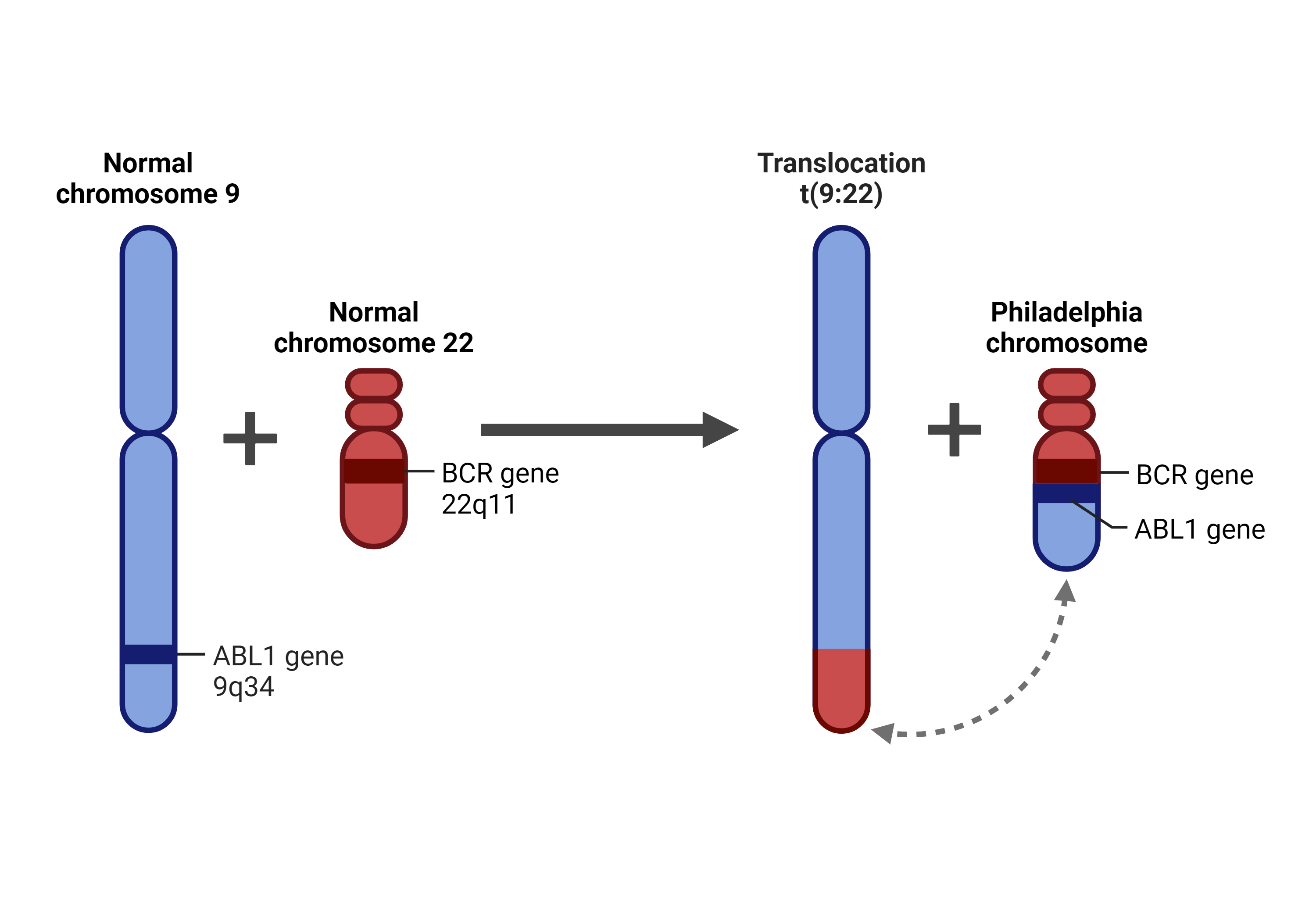 BCR/ABL chromosomal translocation