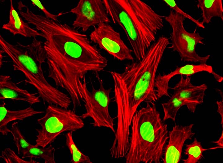 HeLa cells