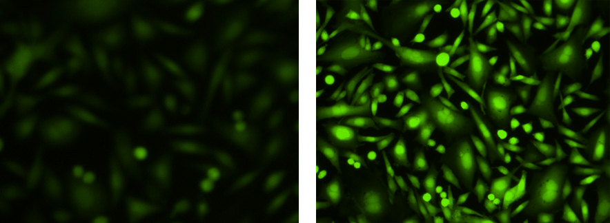 Responses of endogenous P2Y receptor to ATP in CHO-M1 cells without probenecid.