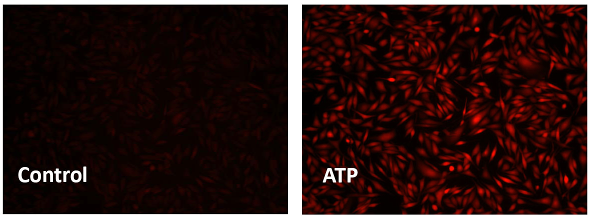 control;ATP