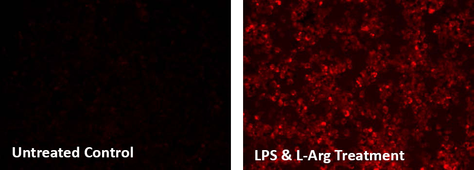 untreated control;LPS and L-Arg treatment