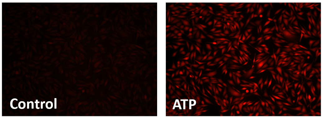 control;ATP
